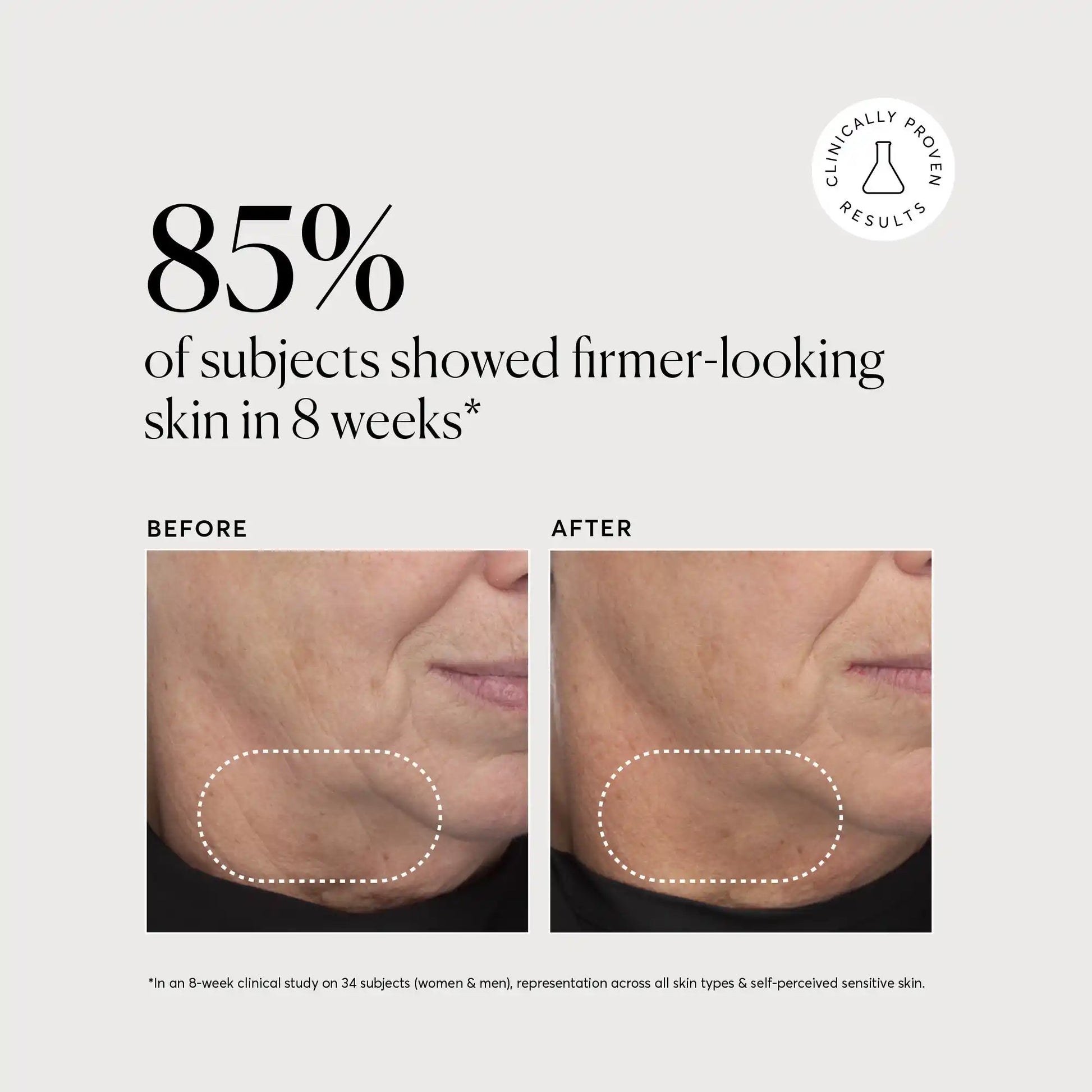 retinol-complex-serum-u6 NATR-10034-Alt-Images-Retinol-Complex-Serum-04.webp